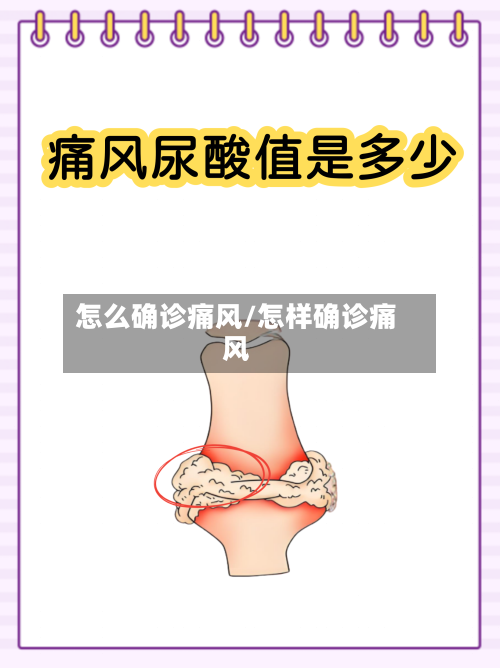 怎么确诊痛风/怎样确诊痛风