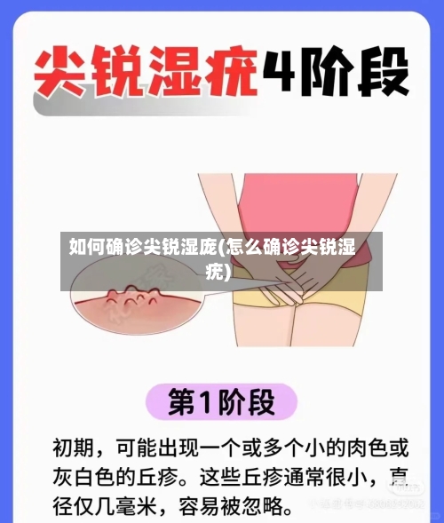 如何确诊尖锐湿庞(怎么确诊尖锐湿疣)-第2张图片