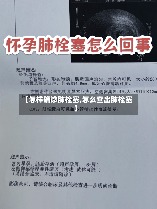 【怎样确诊肺栓塞,怎么查出肺栓塞】-第3张图片