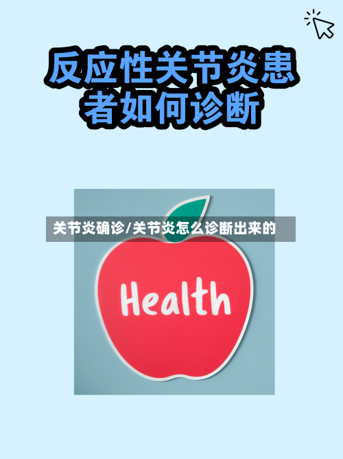 关节炎确诊/关节炎怎么诊断出来的
